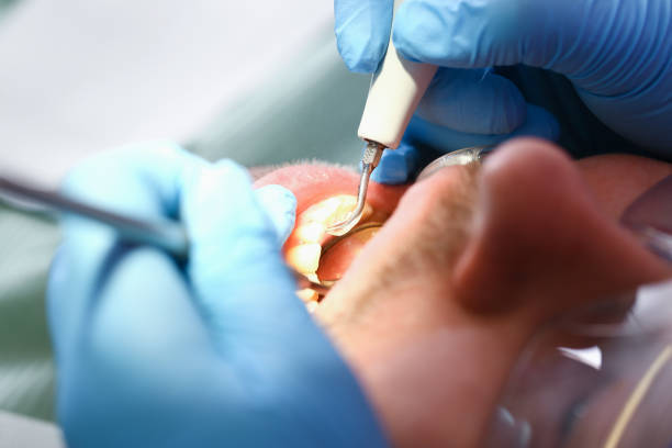 Best Emergency Gum Pain Relief  in Baton Rouge, LA