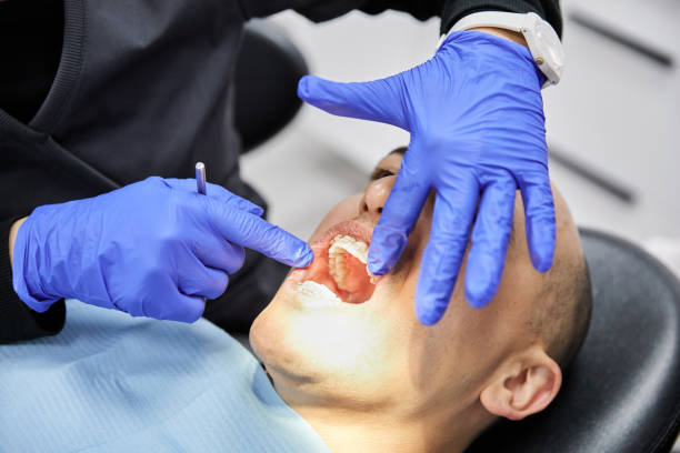 Best Urgent Tooth Repair  in Baton Rouge, LA